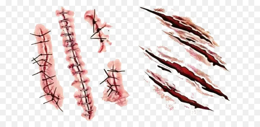 Points De Suture Et Blessures，Blessure PNG