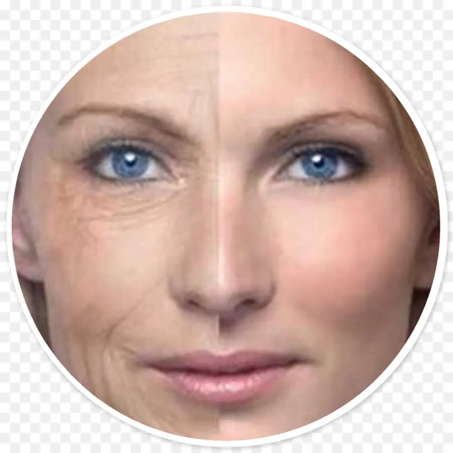 Visage Avant Et Après，Soins De La Peau PNG