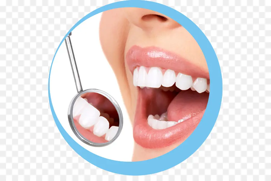 La Dentisterie，Restauration Dentaire PNG