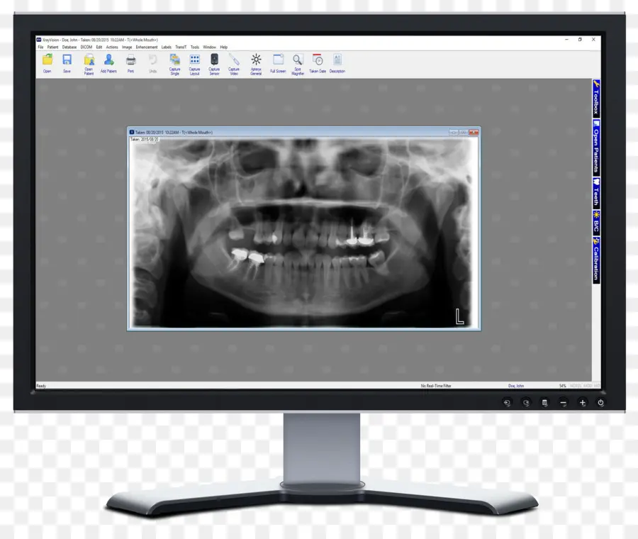 Radiographie Dentaire，Dents PNG