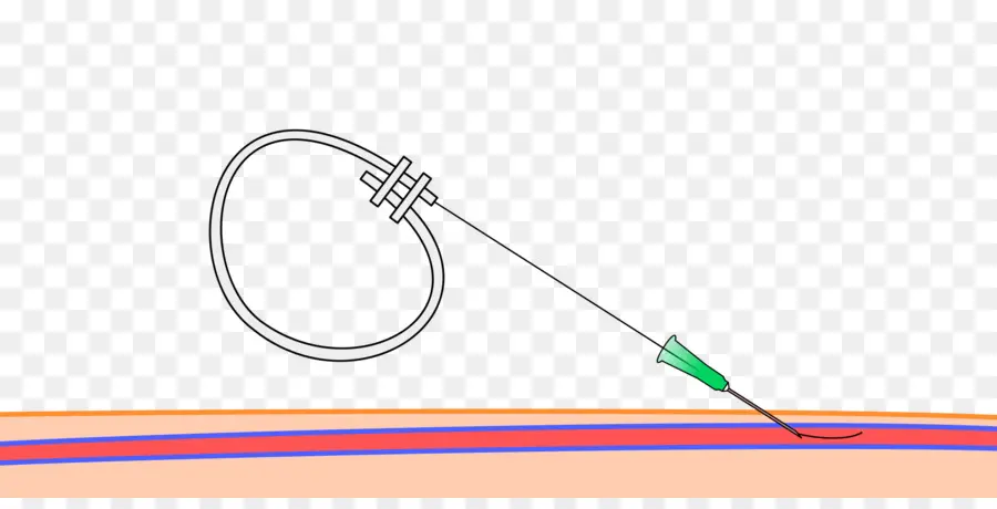 Insertion De L'aiguille，Injection PNG