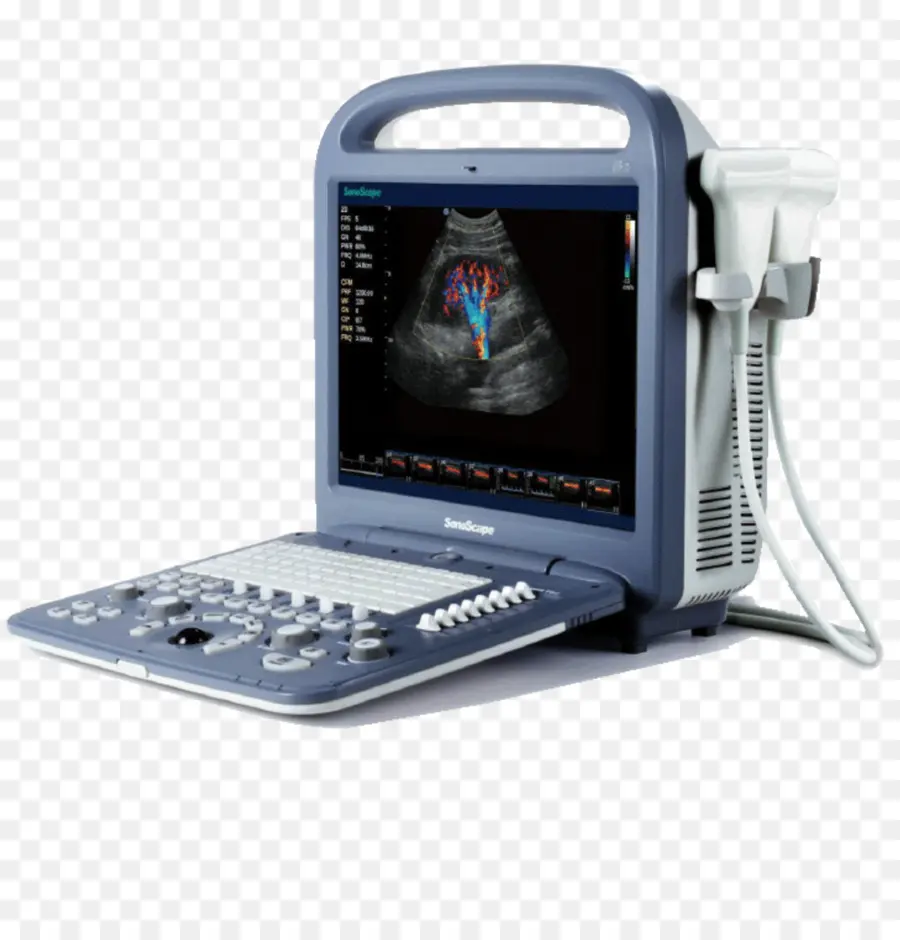 Échocardiographie Doppler，Ultrason PNG
