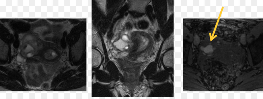 Radiologie，L Imagerie Médicale PNG