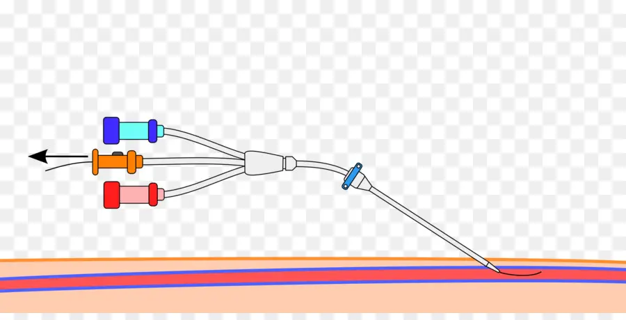 Dispositif Médical，Tubes PNG