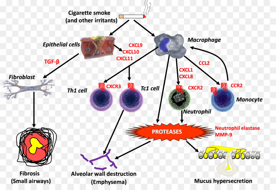 La Maladie Pulmonaire Obstructive Chronique，L Inflammation PNG