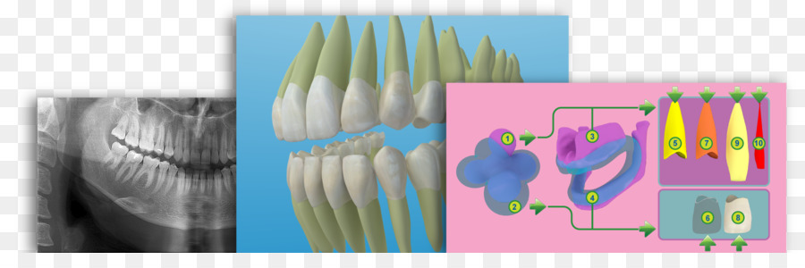 Diagramme Des Dents，Dentaire PNG