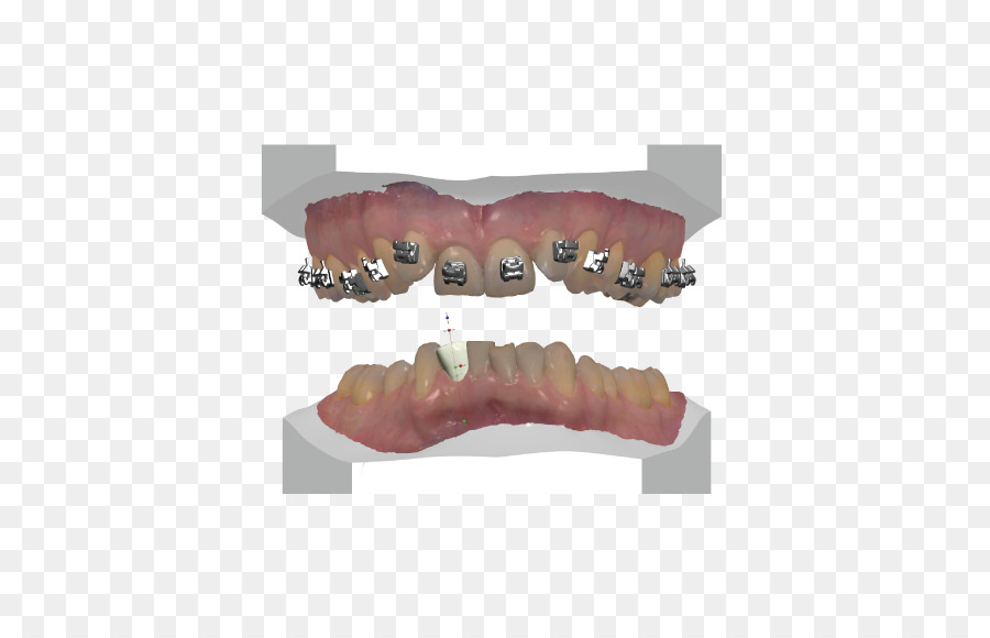 Dent，Dentiers PNG