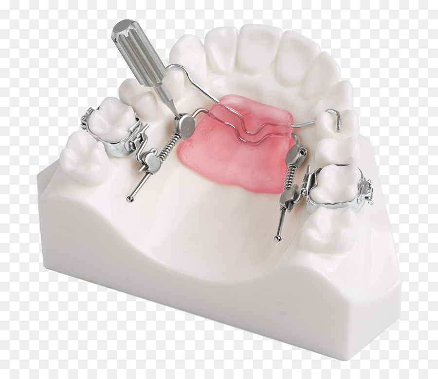 Dynaflex，L Orthodontie PNG