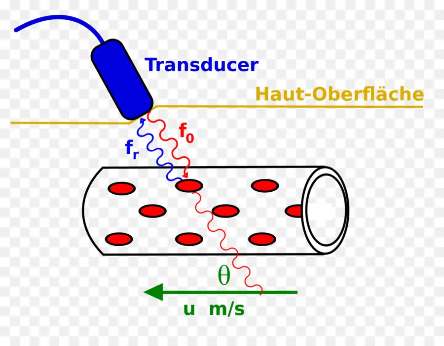 Diagramme D'échographie，Transducteur PNG