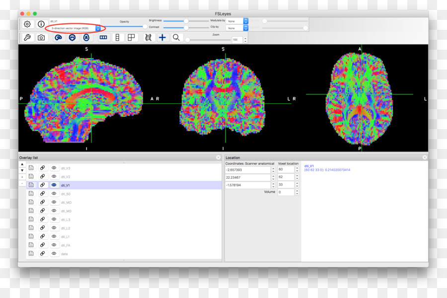 L Irm De Diffusion，Scalaire PNG