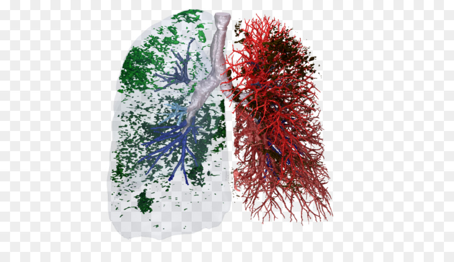 De La Société Respiratoire Européenne，La Fibrose Pulmonaire Idiopathique PNG