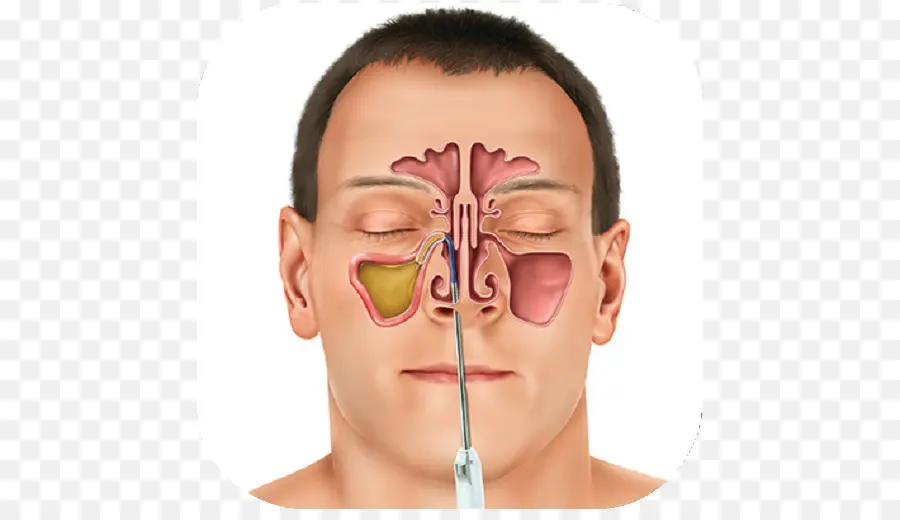 Anatomie Des Sinus，Nez PNG