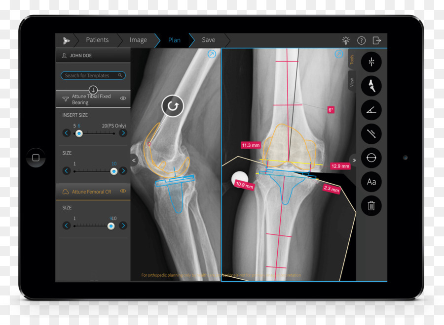 Radiographie Sur Tablette，Diagnostic PNG