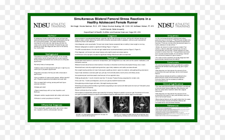 Ndsu Développement Humain Et L éducation，Polaire H7 PNG