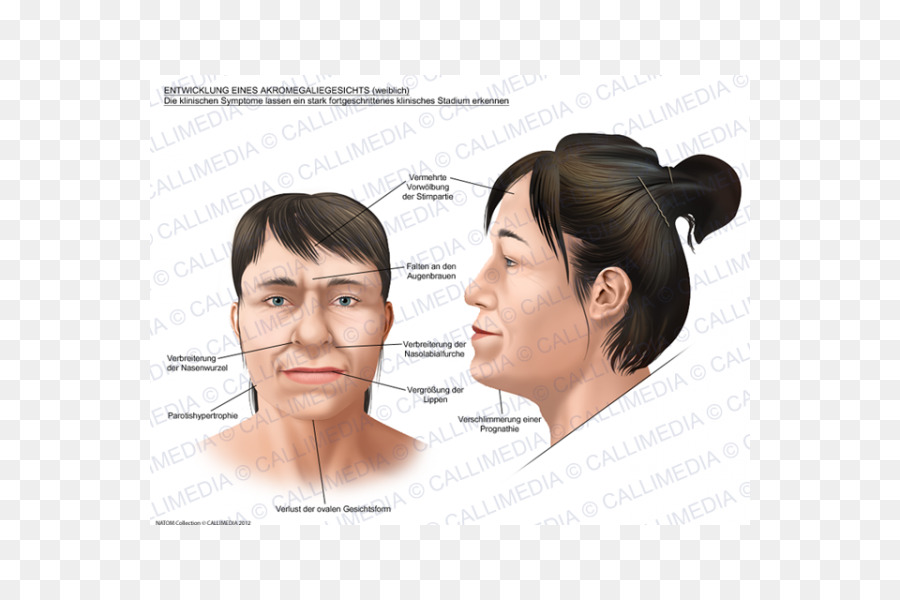 Diagramme Des Caractéristiques Du Visage，Affronter PNG