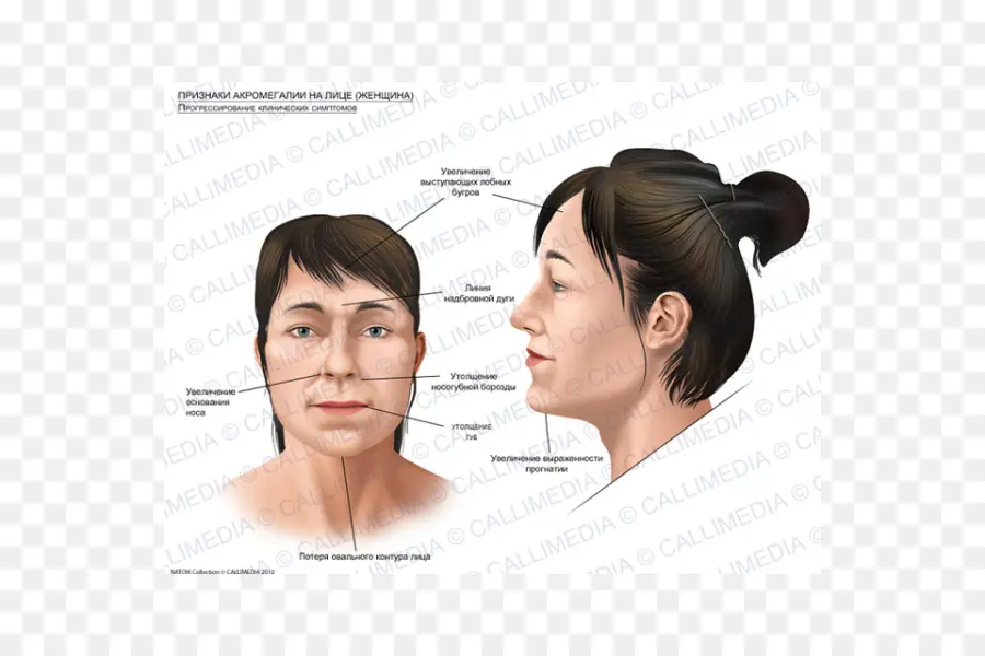 Diagramme Des Caractéristiques Du Visage，Affronter PNG