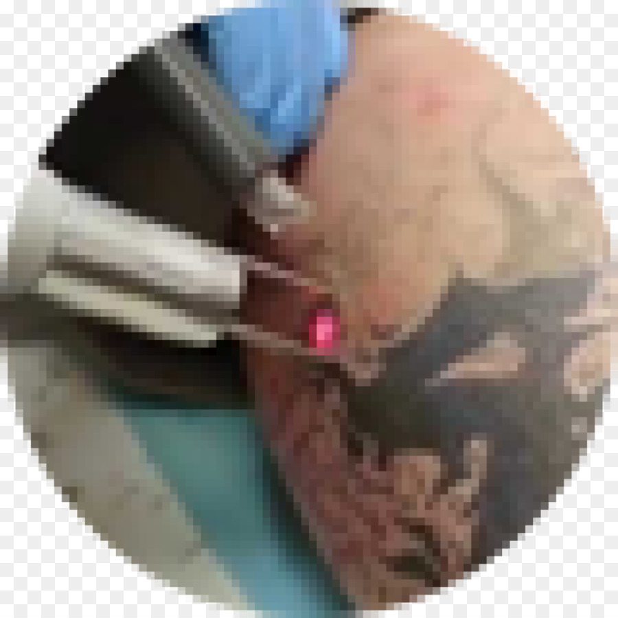 De Retrait De Tatouage De，Tatouage PNG