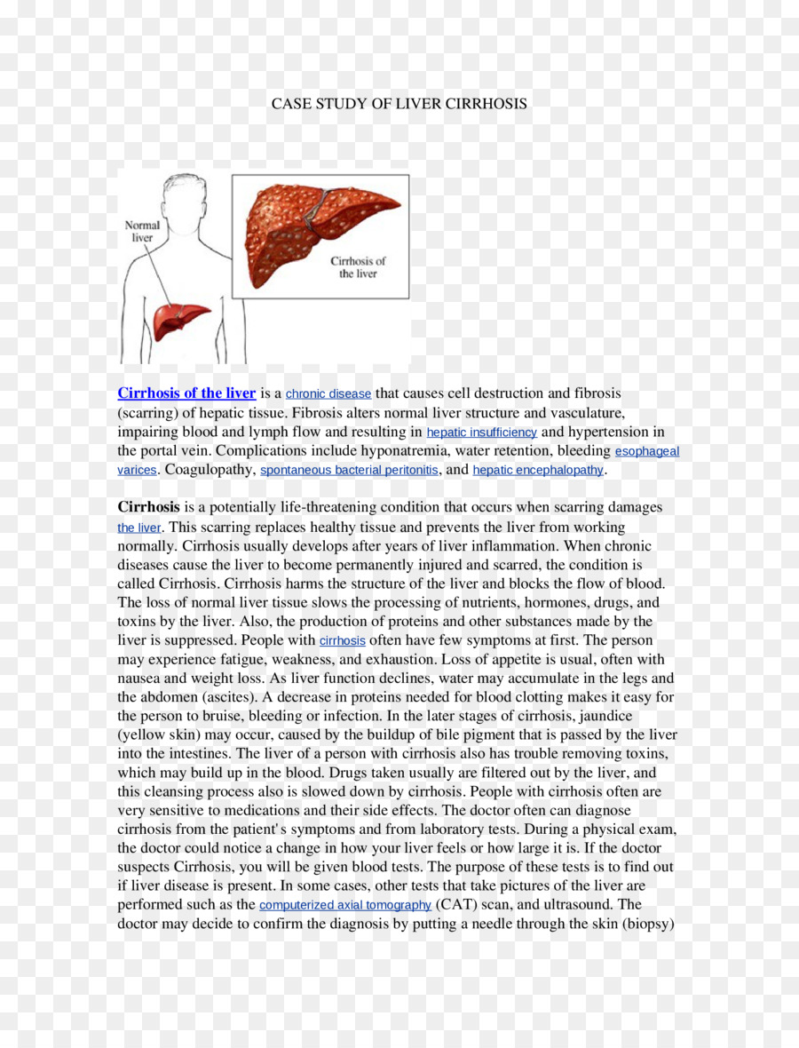 Illustration Médicale，Cirrhose PNG