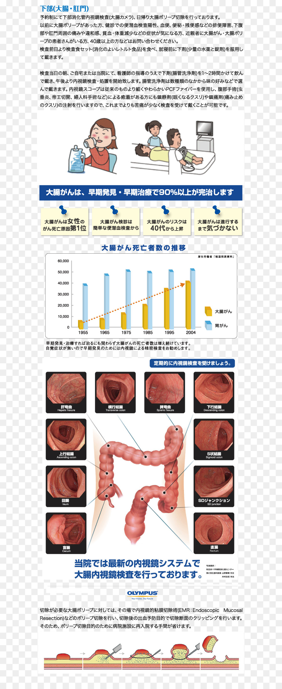 Chigasaki，L Endoscopie PNG