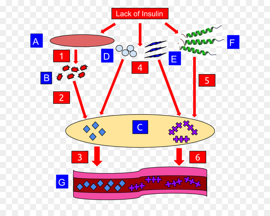 L Acidocétose Diabétique，L Acidocétose PNG