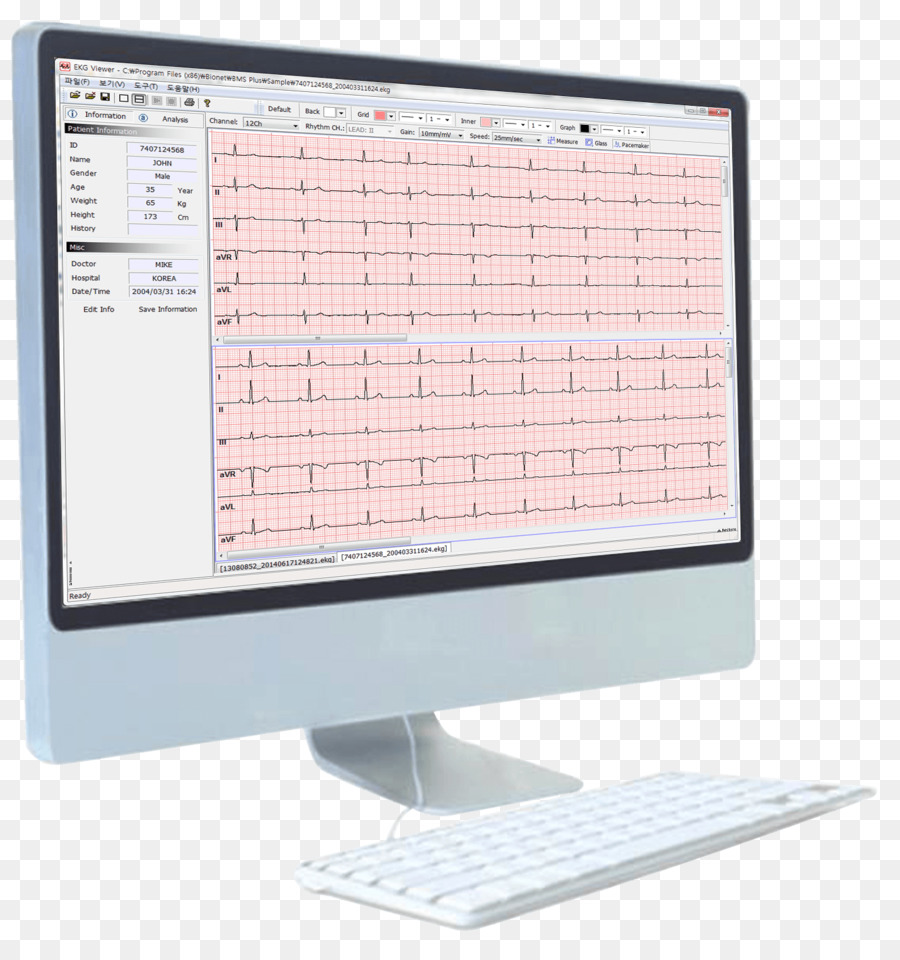 Artun Médical Service Technique，électrocardiographie PNG