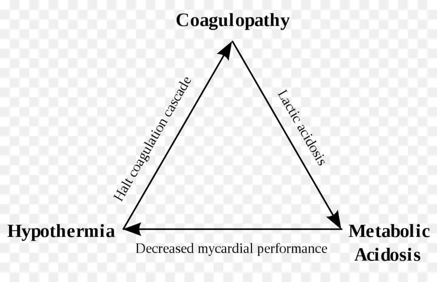 Schéma Médical，Triangle PNG