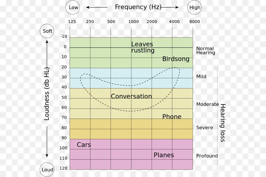 Tableau De Perte Auditive，Fréquence PNG