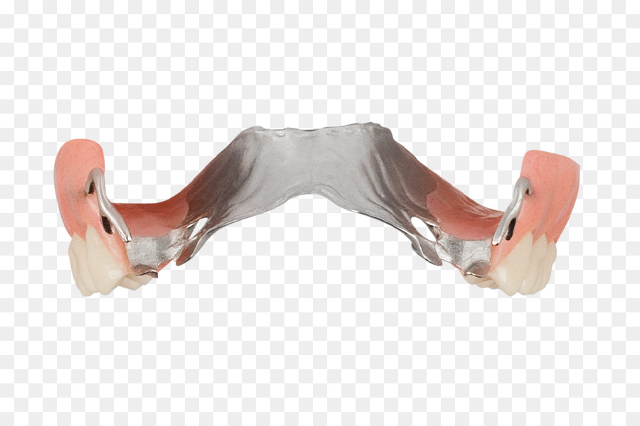 Les Prothèses Dentaires，Prothèse Partielle Amovible PNG