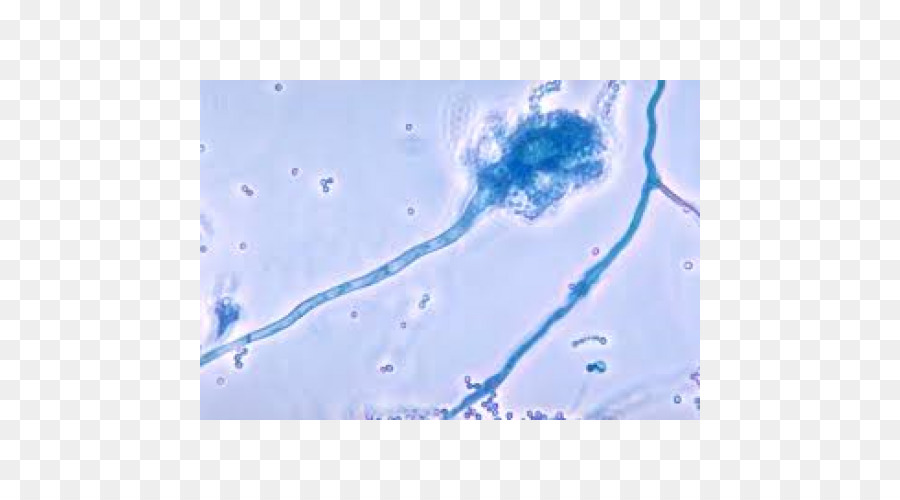 Aspergillus Fumigatus，L Aspergillose PNG