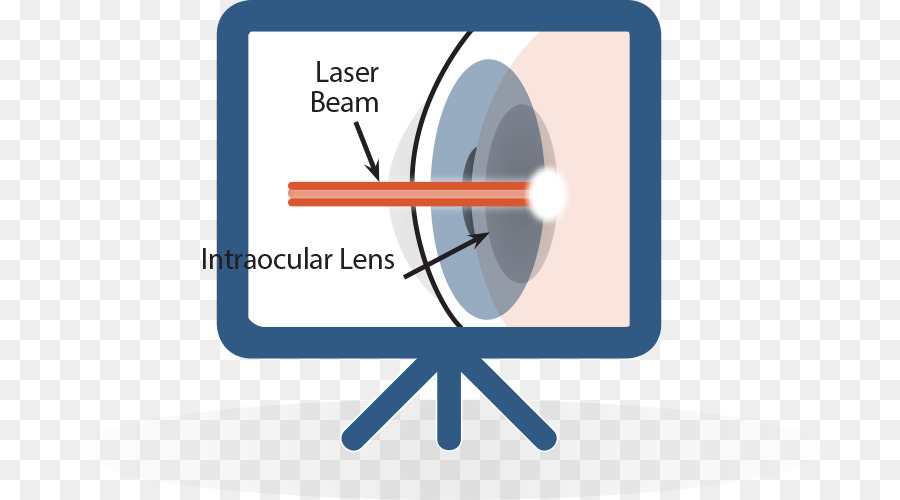 Cataracte，Laser PNG