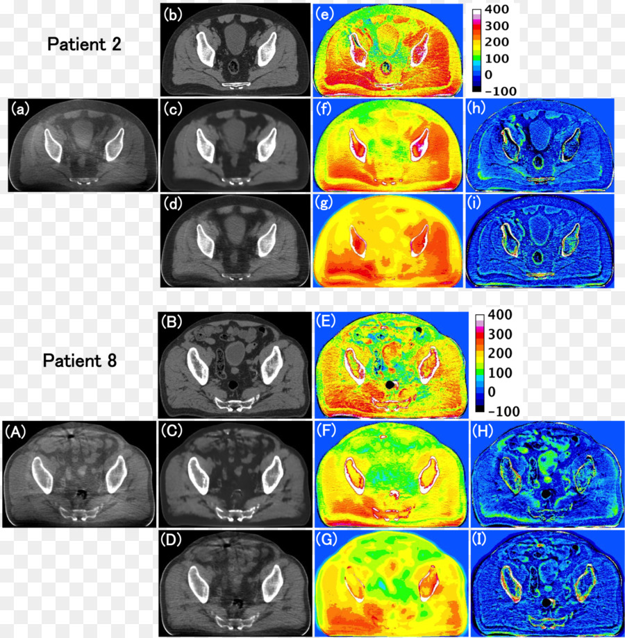 L Imagerie Médicale，Tomographie Calculée Par Faisceau Conique PNG