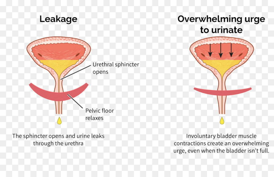 Vessie Hyperactive，Vessie Urinaire PNG