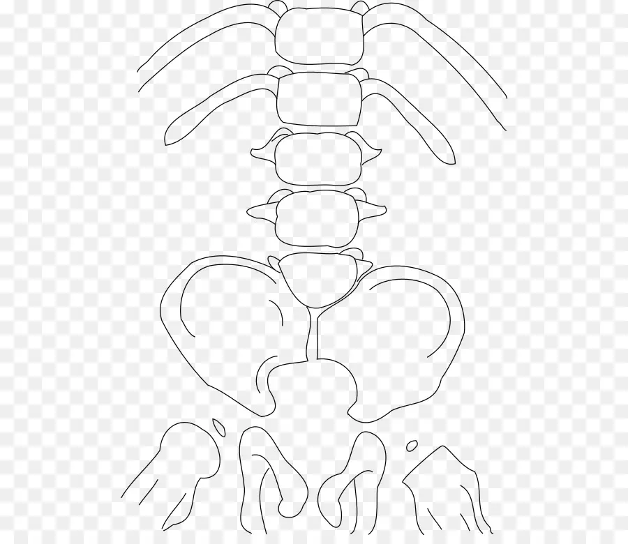 Le Syndrome De Régression Caudale，Le Syndrome De PNG