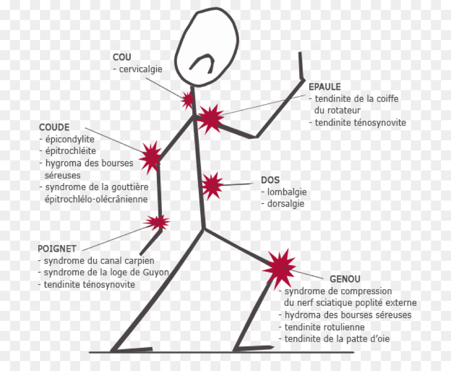 Diagramme Des Points Douloureux，Corps PNG