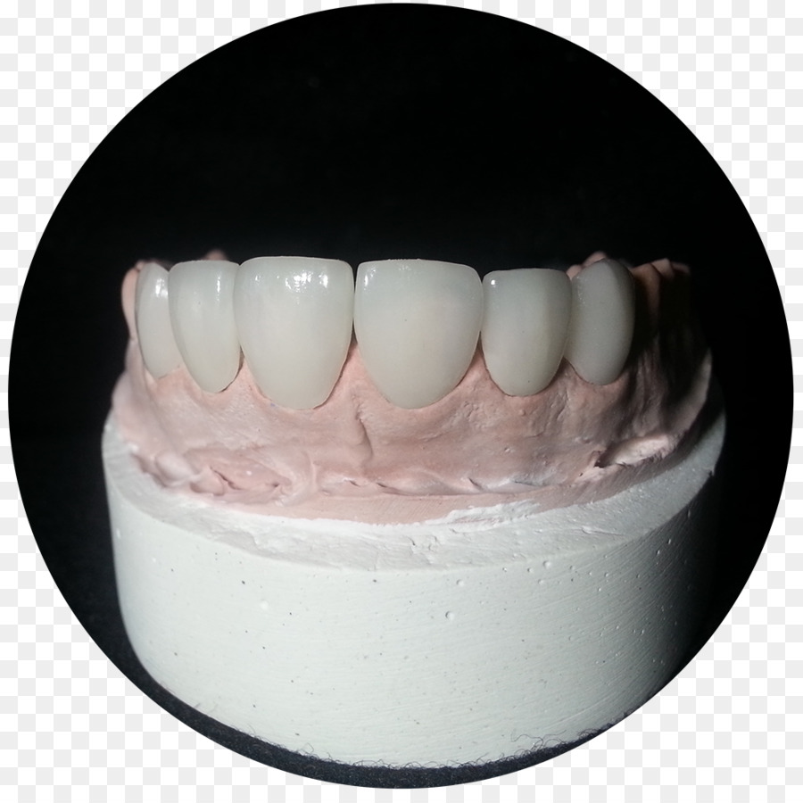 Viax Dentaire Panamá，Céramique PNG