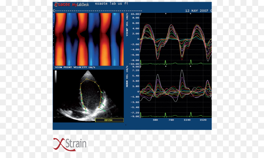 Cardiologie，Les Maladies Cardiovasculaires PNG