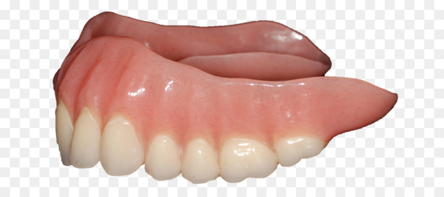 Les Prothèses Dentaires，Dents Humaines PNG