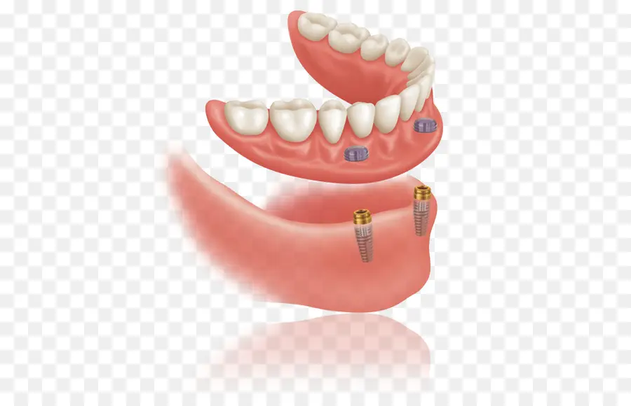 Dentiers，Dents PNG