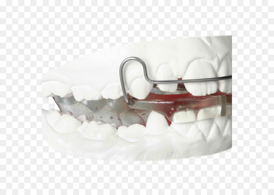Orthodontie，Technologie Orthodontique PNG