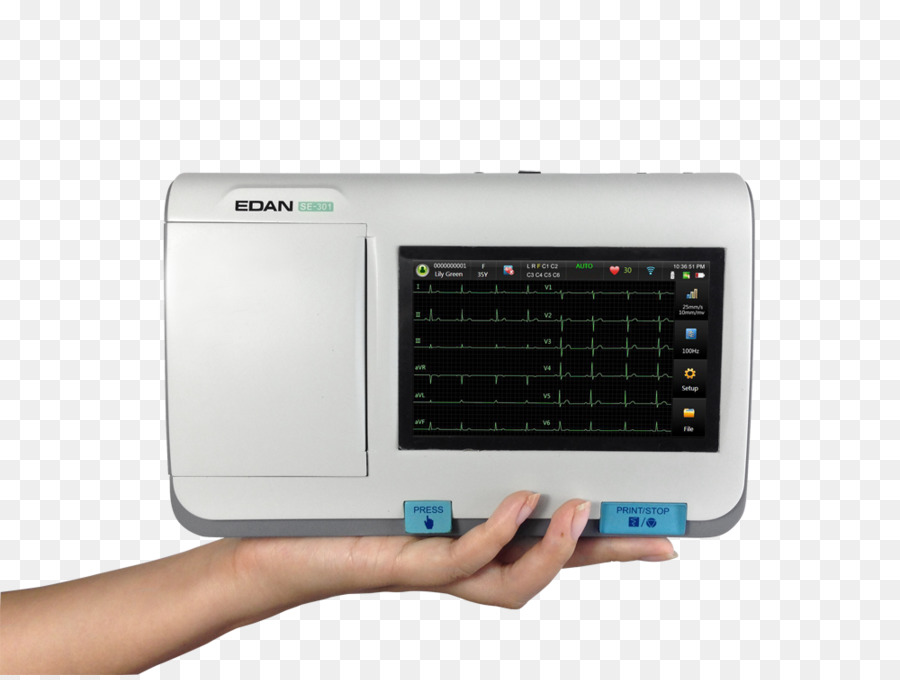électrocardiographie，électrocardiogramme PNG