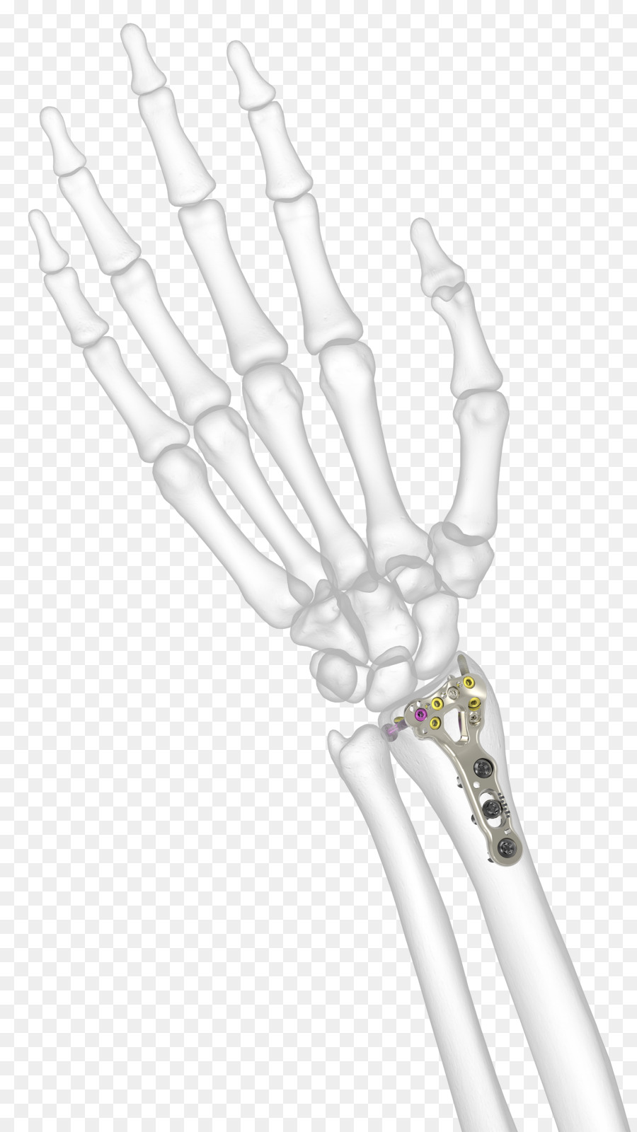 Radiographie De La Main，Os PNG