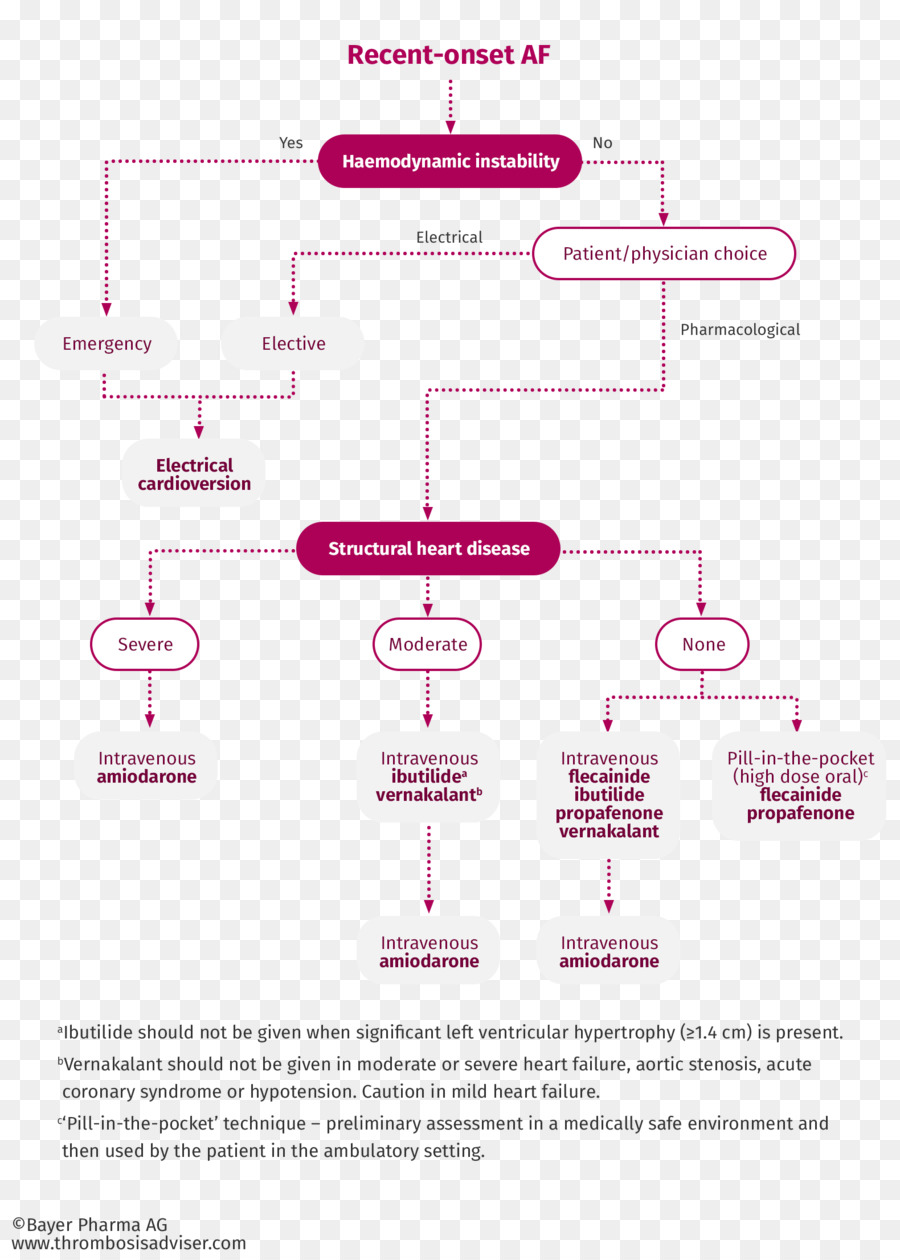 Diagramme，Ligne PNG