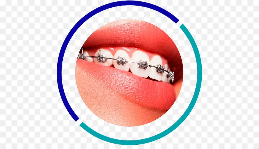 L Orthodontie，La Dentisterie PNG