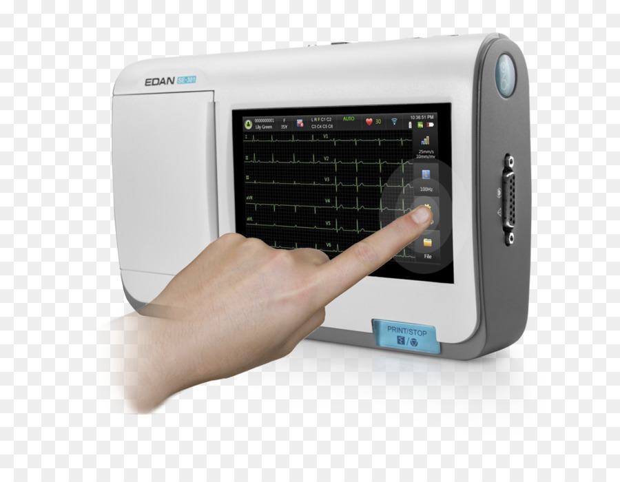 électrocardiographie，La Médecine PNG