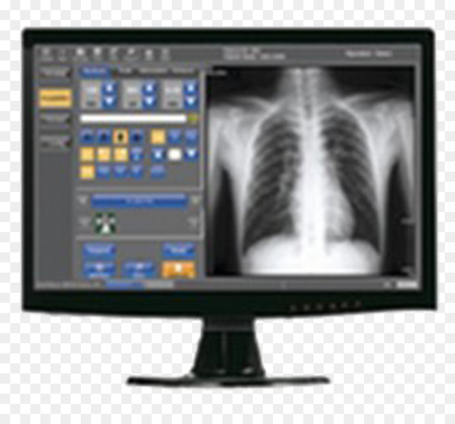 Moniteur à Rayons X，Radiographie PNG