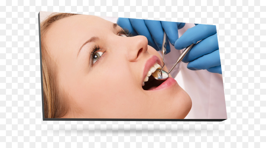 La Dentisterie，Dent PNG