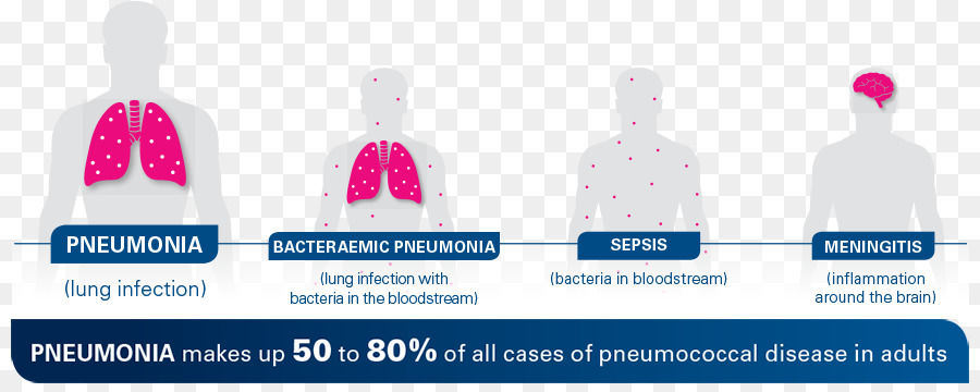 Infographie Sur La Pneumonie，Pneumonie PNG