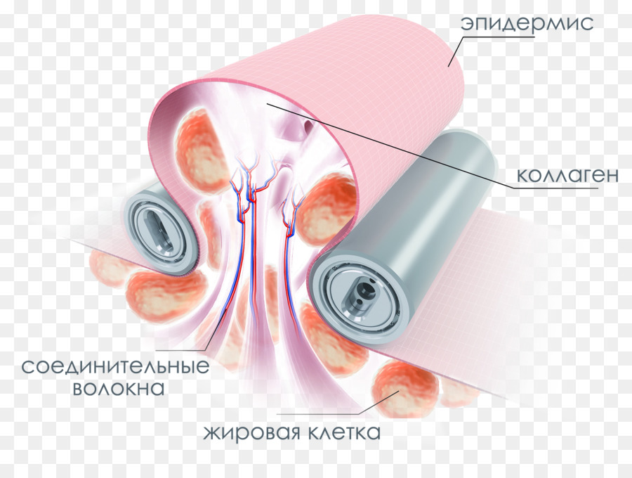 La Cellulite，La Peau PNG