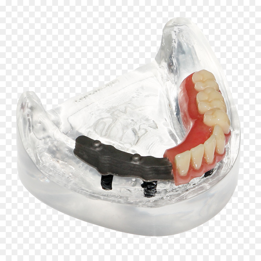 Les Prothèses Dentaires，Dent PNG