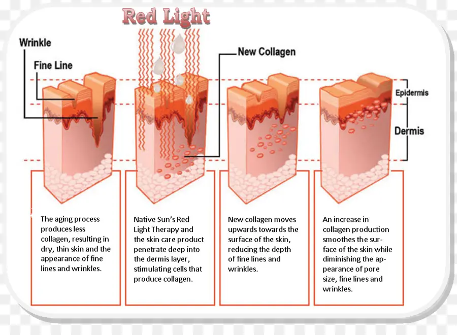 Diagramme De Thérapie Par La Lumière Rouge，Feu Rouge PNG